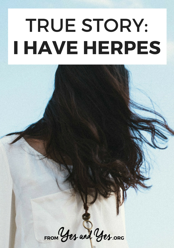 Everything you need to know about dating someone with herpes
