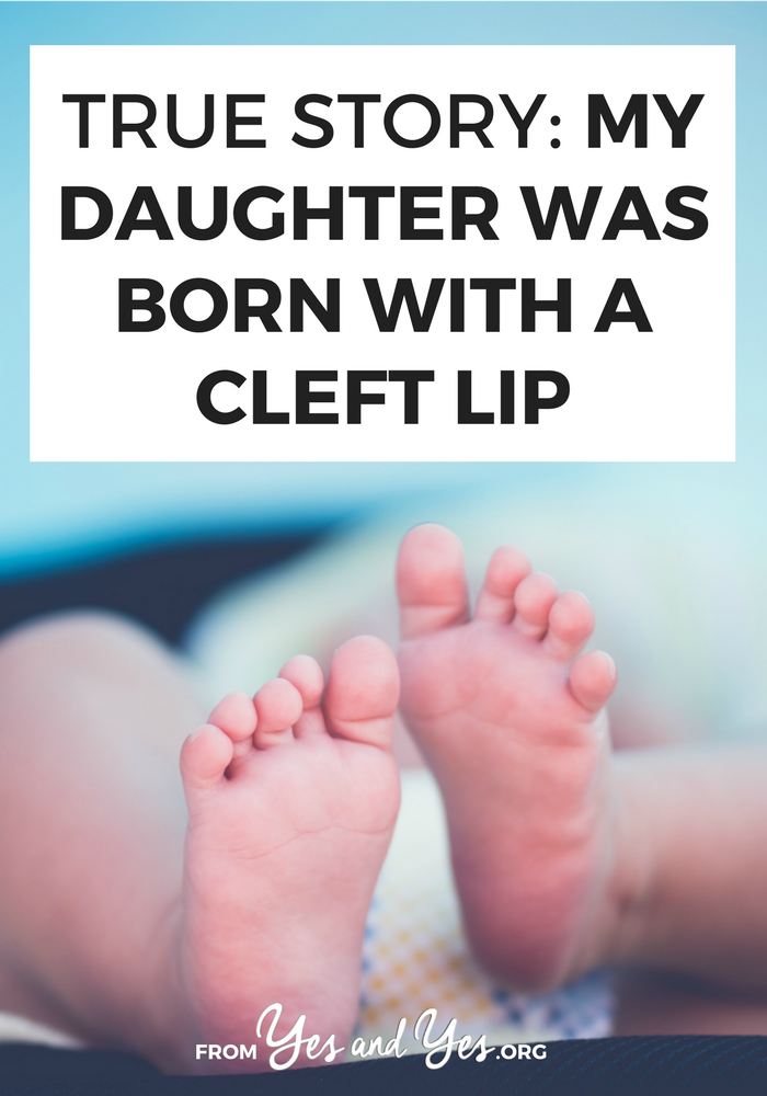 How would you feel if - minutes after giving birth - you were told your daughter had a cleft lip and would need surgery within the next year? That's what happened to Sarah. This is her story. 