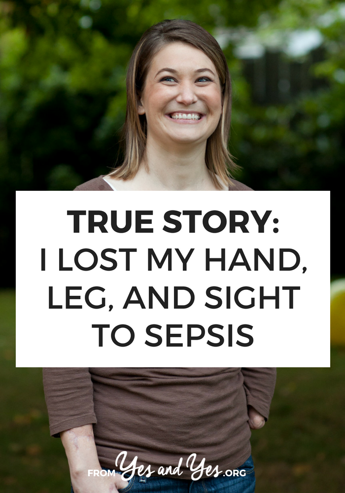 How would you navigate life after a sepsis infection lead to the amputation of your leg and hand and loss of your eyesight? Click through for one woman story. 